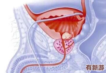 手腳綁起來(lái)拿刷子刷尿道孔的行為背后隱藏著怎樣的心理與動(dòng)機(jī)